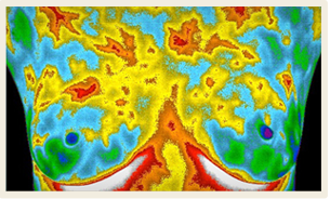 home_thermography
